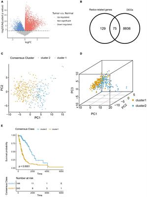 Impact of redox-related genes on tumor microenvironment immune characteristics and prognosis of high-grade gliomas